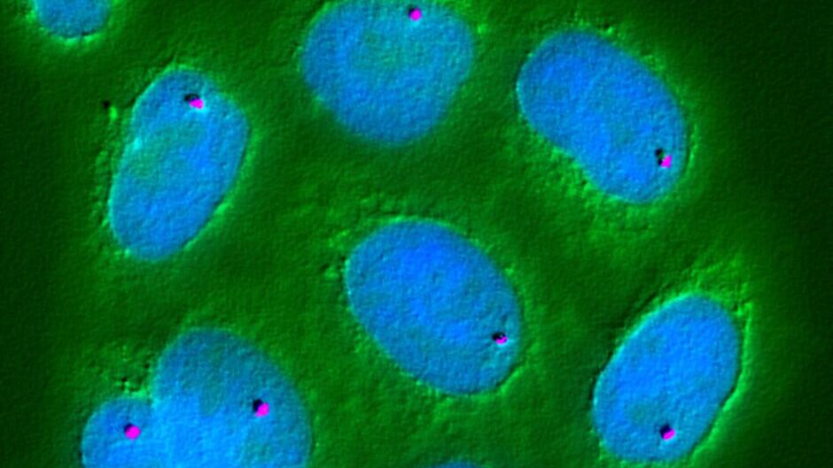 ScPoli ermöglicht Multiskalenrepräsentation von Zellen und Proben