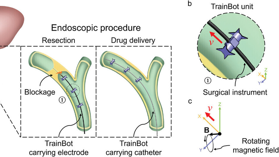 Stärker im Team: Miniaturroboter im Konvoi für die endoskopische Chirurgie